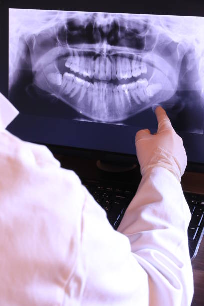 Best Tooth Infection Emergency Dentist  in Fordoche, LA