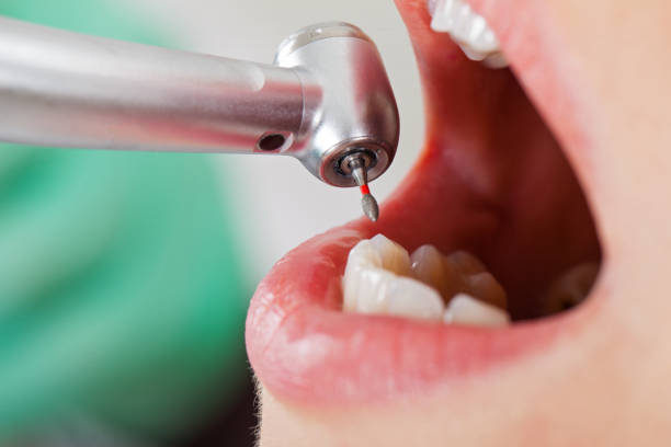 Best Emergency Tooth Extraction  in Fordoche, LA